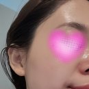 빈스샵 | 김해 삼계동 피부관리 빈스뷰티 더미브 관리 내돈내산 후기