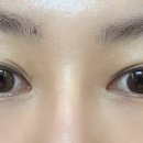 다본안경 위드렌즈 이미지