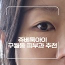 이노 스킨케어 | 인천피부과 추천 스킨부스터 쥬베룩아이 눈가 주름 탄력 찐 시술 후기!!!