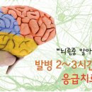 뇌졸중 이미지