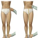 보문효사랑요양병원 이미지