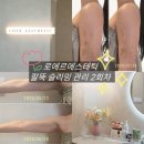 마산2 | 마산에스테틱 로에르에스테틱 팔뚝관리 2회차 후기｜ 부유방 라인 변화 체감중