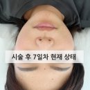 봉암중앙의원 네이버블로그
