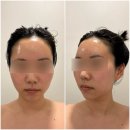 분당-206 | 분당경락 [오은영K뷰티샵] 서현에스테틱에서 윤곽관리 받은 후기