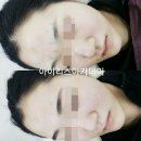 아이리스 아카데미 네이버블로그
