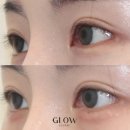 글로우의원 이미지