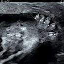 분당-22 | 임신 22주차 분당제일여성병원 2차 정밀초음파 후기(검사 시기 아기 얼굴 심장 남편 동행)