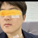 피어랑의원 네이버블로그