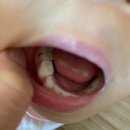 스마일리소아치과의원 이미지