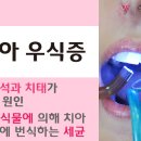 연수웰치과 이미지