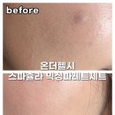온더헬시