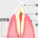 정전기 예방법... 치통은 왜 밤에? 이미지