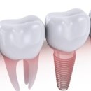 마리플란트치과의원 이미지