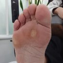 바른네일레푸스 네이버블로그