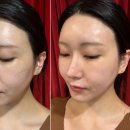 임효성힐링 | 대구 비대칭교정 수성구 얼굴경락 잘하는 임효성힐링 후기
