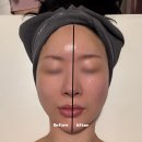 창원상남동 피부관리, 작은얼굴부터 탄력관리까지 한 번에!&lt;끌리메&gt;