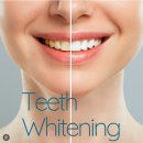 미소가있는보스톤치과의원 | 잠원역 연세보스톤치과 안전하고 전문적인 치아미백