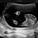 봄빛산부인과의원 이미지