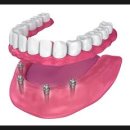 한결치과기공소 이미지