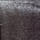 고익수성형외과의원 | 고익수 성형외과 이물질제거 후기