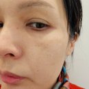 갤러리 서현 | 분당 서현역 갤러리 피부과 피코슈어 레이저 비타민 관리 후기