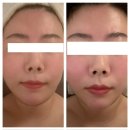 운양역 | 연예인들도 받는 김포피부관리 약손명가 운양역점 후기