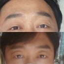 명신헤어라인 | 역삼눈썹문신 반영구 자연눈썹 잘 하는 곳 남자눈썹문신 후기