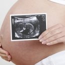 달성군화원읍보건지소 이미지