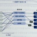뇌가멈추기전에 이미지