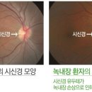 굿모닝빛안과의원 이미지