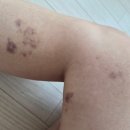 대방역 4번 출입구 | 30대 여자 취미 운동 추천! 다이어트에 좋은 전신 운동 폴댄스 학원 오하운폴댄스보라매점 체험 후기