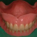 상아치과재료 이미지