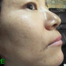 (주)비엘코리아 | [맘스홀릭지후맘/(주)비엘코리아]1일1팩 안나가스피비타민30 마린스타 앰플 마스크팩