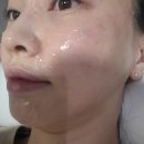광은약국 | 줄기세포피부주사 후기, 광채나는 피부 원하시는분