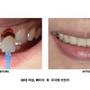 미미치과 이미지