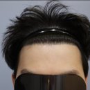 압구정모비앙의원 이미지