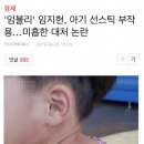 '임블리' 임지현, 아기 선스틱 부작용…미흡한 대처 논란 이미지