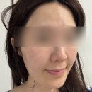 40대 클렌징 추천 야다 아줄렌 카밍 클렌징밤 솔직후기
