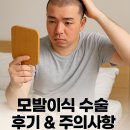 우연이미용실 | 💉 모발이식, 진짜 효과 있을까? 실제 수술 후기와 주의사항 총정리