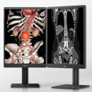 3840 | Medical &amp; Hospital Equipment Show 국제의료기기 병원설비 전시회) LG 의료용 모니터 참가 후기