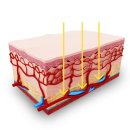서원장 | 티타늄리프팅 볼패임과 통증 걱정된다면, 시술 전 꼭 알아야 할 핵심 원리