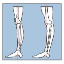 빅브로짐 성수점 은하 T / 백니 (Back knee)/ 반장슬 교정 후기