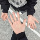 너.애.개 | 애한테 수족구 옮음 성인 수족구 걸린 후기