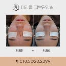 미라클피부관리실