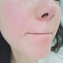 신림역왁싱 에스테틱여운 페이스왁싱 헤어라인 눈썹 인중후기