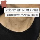 참푸른병원 | 방배동 피부과 편평사마귀 111개나 제거하고 23일 동안의 변화 과정!