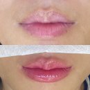 합정약국 | 합정 입술 반영구 잘하는 곳 유주얼 전후사진 일주일 기록 추천 통증 후기