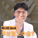 피니쉬성형외과의원 네이버블로그