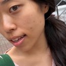콜라보엑스 | 쥐젖 비립종 요철 없애는 방법 | 비렌느 스팟 엑스 사용 후기