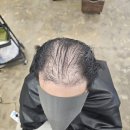 수원 남자 탈모펌, 리턴헤어 커버 파마 가격